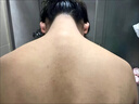 DAGO 背粒消喷雾升级美肌祛痘毛囊炎去胸前硬疙瘩痘印背部痘消长痘 实拍图