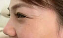 施逅鱼尾纹眼角皱纹眼袋贴黑眼圈眼周提拉紧致补水去除男女士精华眼贴 5盒【25对】巩固装 实拍图