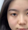 Newliann医用黑面膜械字号祛痘祛痘印术后消炎修复医美美白补水修护男士女 实拍图