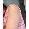 崎美玖川鸡皮肤疙瘩毛囊角化专用去除大腿胳膊手臂脖子鸡皮肤去除角质神器 1盒装【鸡皮肤克星】 身体磨砂膏去鸡皮肤去角质嫩白全身 实拍图