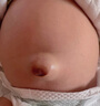 仁和医用疝气固定带2条装 宝宝脐疝带  婴幼儿压疝包凸疝气带肚脐贴 实拍图