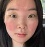 医用冷敷贴面膜械字号医美术后消炎美白补水晒后修复收缩毛孔祛痘淡化痘印生长因子重组三型人源胶原蛋白敷料 实拍图