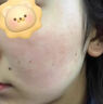 透真油橄榄修复精华液皮肤屏障受损泛红敏感舒缓修护原液祛痘收缩毛孔 实拍图