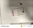 万孚艾滋病梅毒乙肝丙肝 传染病四项检测试纸卡 HIV试纸四联4项四合一 实拍图