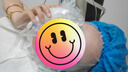 敷尔佳白膜医用透明质酸钠修复贴1盒/5片轻中度痤疮【新旧版随机发】 实拍图