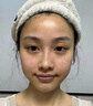 本田制药烟酰胺凝胶医用美白祛斑淡化黑色素色斑烟酰胺男女专用1盒 实拍图