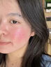 医用冷敷贴面膜械字号医美术后消炎美白补水晒后修复收缩毛孔祛痘淡化痘印生长因子重组三型人源胶原蛋白敷料 实拍图