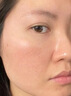 Newliann医用重组胶原蛋白修复敷料乳液人表皮生长因子凝胶皮肤屏障面霜 实拍图