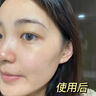 E'YEARN美白水乳套装淡化黑色素保湿舒缓修护烟酰胺祛斑美白水乳 一盒装 实拍图