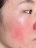 Newliann医用重组胶原蛋白修复敷料乳液人表皮生长因子凝胶皮肤屏障面霜 实拍图