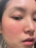 医用冷敷贴面膜型械字号透明质酸钠修复贴敷料医美术后消炎去红美白补水晒后修复收缩毛孔祛痘控油淡化痘印 实拍图