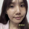 透真377美白精华液次抛淡化黑色素祛斑去黄提亮改善暗沉肤色烟酰胺女 实拍图