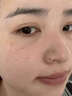 肤研祛斑霜去老年斑专用特效非药一夜消黄褐斑雀斑晒斑女男士医用的药 特效膏3盒【永不再长斑】买2送1 强力祛除手部脸部淡化黑色素纯中药正品进口 实拍图