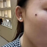 川井弘岩去痣点痣膏水无痕脸部痦子扁平疣瘊子面部黑痣男女士通用 实拍图