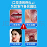 同仁堂医用漱口水 去口臭牙结石黄牙周炎专用消炎口腔溃疡便携含漱液 实拍图