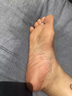 本安制药脚气喷雾剂止痒脱皮烂脚丫真菌感染脚气脚臭专用乳膏杀真菌 3盒 实拍图