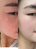 OHBT黄芪面膜10片抗皱紧致抗衰老补水熬夜焕白淡斑女男士金榜第1名 实拍图