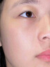 医用精华液械字号收缩毛孔粗大修复细致去黑头粉刺闭口男士女士祛痘印黑色素沉淀控油淡化痘印痘坑透明质酸钠 实拍图