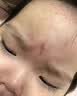 北京同仁堂点痣疤痕修复点痣结痂脱落修复凝胶激光术后去红印黑印修复液医用 点痣疤痕修复结痂脱落修复凝胶 实拍图