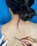 示博士鸡皮肤疙瘩搭毛囊角化症专用的药去角质大腿手臂去除神器特傚膏用 三套【中度鸡皮】鱼鳞皮蛇皮疙瘩 搭身体乳去鸡皮毛囊角质疙瘩品用 实拍图