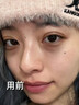 焦博士日本眼霜去眼袋消除重度眼袋专用黑眼圈重度去除女男士中老年神器 实拍图