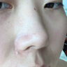 康佳（KONKA）可视化吸黑头清理神器去小气泡黑头仪铲粉刺清洁面部毛孔美容仪黑头吸出器生日七夕礼物送男女友 实拍图