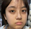 焦博士日本眼霜去眼袋消除重度眼袋专用黑眼圈重度去除女男士中老年神器 实拍图