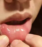 纽医生口腔溃疡贴片膜专用口腔溃疡凝胶喷剂成人儿童溃疡贴可搭配西瓜霜 实拍图
