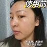 沃森博士377美白祛斑面膜补水淡斑去黄黑色素烟酰胺保湿提亮肤色 实拍图