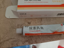 丽芙维A酸乳膏0.1%*18g+尿素乳膏30g去祛痘药膏医用淡化痘印黑头去鸡皮肤黑色素可搭异维A酸凝胶囊 实拍图