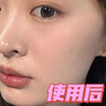 OHBT377美白祛斑面霜50g女男士保湿去黄淡化黑色素黄褐斑雀斑护肤品 实拍图
