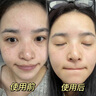 透真377美白精华液次抛淡化黑色素祛斑去黄提亮改善暗沉肤色烟酰胺女 实拍图