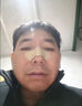 御医匠鼻炎鼻贴过敏性鼻炎鼻窦炎贴鼻塞鼻痒治根穴位贴儿童成人专用膏药 【单盒装】 实拍图