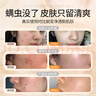 倾颜硫磺洗面乳控油保湿除螨虫去黑头男女士通用洗面奶洗脸皂2支装 实拍图