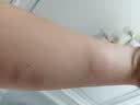 艾草枕头颈椎枕成人睡觉专用颈椎病专用圆枕头艾灸枕头护颈椎枕头 电加热款大号骨头枕-清新绿 实拍图