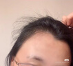 【男士进阶套装】蔓迪生发喷雾90ml*2瓶+精灵瓶10ml*2瓶 5%米诺地尔酊（浓密头顶发际线 随行轻松生发） 实拍图