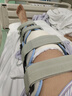 麦德威（medwe） 医用膝关节固定支具下肢支架后交叉韧带术后膝盖腿部骨折护具 实拍图