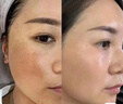 维特丝面膜美白补水保湿淡斑男女士去黄气提亮肤色暗沉紧致抗皱熬夜修复 实拍图