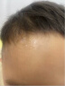 芭克kelocote官方硅凝胶巴克疤克疤膏祛疤膏贴去 疤改善治疗疤痕15g 实拍图