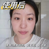 沃森博士377美白祛斑面膜补水淡斑去黄黑色素烟酰胺保湿提亮肤色 实拍图