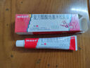999三九皮炎平复方醋酸地塞米松乳膏 20g:15mg 20g/支 神经性皮炎 接触性皮炎 脂溢性皮炎 慢性湿疹 皮肤瘙痒 实拍图