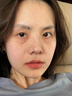 润凰美白祛痘淡斑毛孔收缩精华液抗皱紧致精华抗衰老紧致烟酰胺女男士 1瓶 【挑战3天白嫩肌】 实拍图
