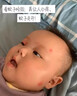 dyey云南本草叮叮消蚊虫叮咬止痒消包膏婴儿滚珠叮立消儿童蚊子专用 实拍图