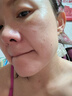 ORGINESE水杨酸控油祛痘精华面霜祛痘膏淡化痘印痘坑去痘痘和痘印男女学生 实拍图