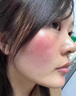医用冷敷贴面膜械字号医美术后消炎美白补水晒后修复收缩毛孔祛痘淡化痘印生长因子重组三型人源胶原蛋白敷料 实拍图