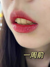 施朗德牙结石溶解液30ml 牙石清理去除神器速效喷雾专用喷剂 实拍图
