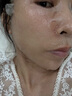 FANCIE MANLIN医用修复面膜械字号水光针熬夜军训晒后医美激光术后点痣斑敏感肌 5盒装【25贴】 实拍图