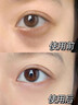 焦博士日本眼霜去眼袋消除重度眼袋专用黑眼圈重度去除女男士中老年神器 晒单实拍图