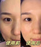 OHBT黄芪面膜10片抗皱紧致抗衰老补水熬夜焕白淡斑女男士金榜第1名 实拍图