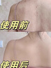 尊蓝硫磺除螨沐浴露500g控油止痒除螨抑菌祛螨虫背痘持久留香沐浴液 实拍图